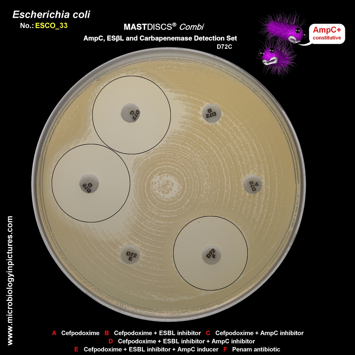 mastdiscs combi, AmpC constitutive