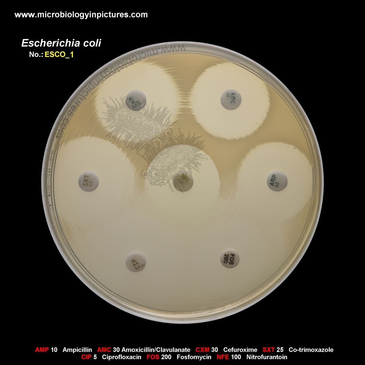 E.coli susceptible to antibiotics