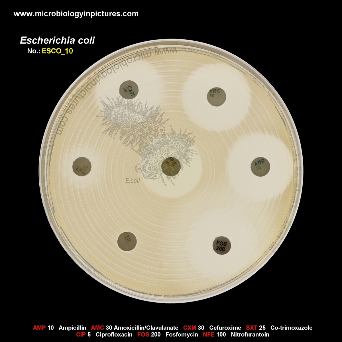 E.coli resistant to TMP-SMX and ciprofloxacin