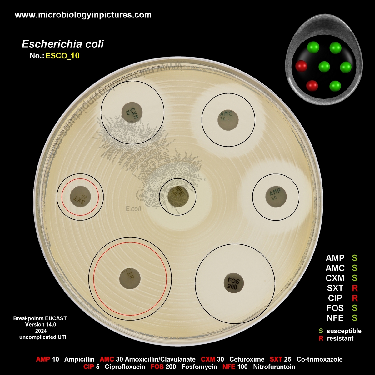 E.coli resistant to TMP-SMX and ciprofloxacin