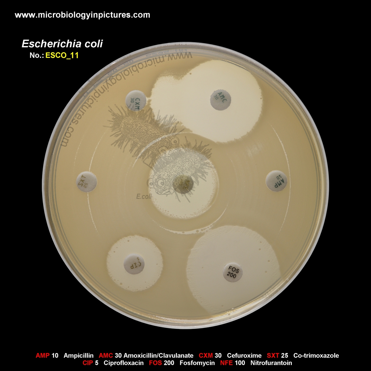 E.coli ESBL positive