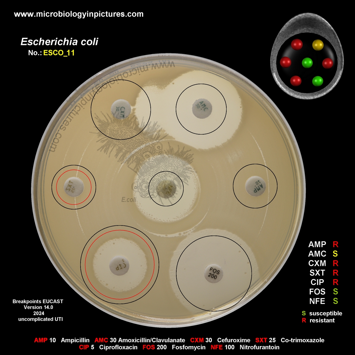 E.coli ESBL positive