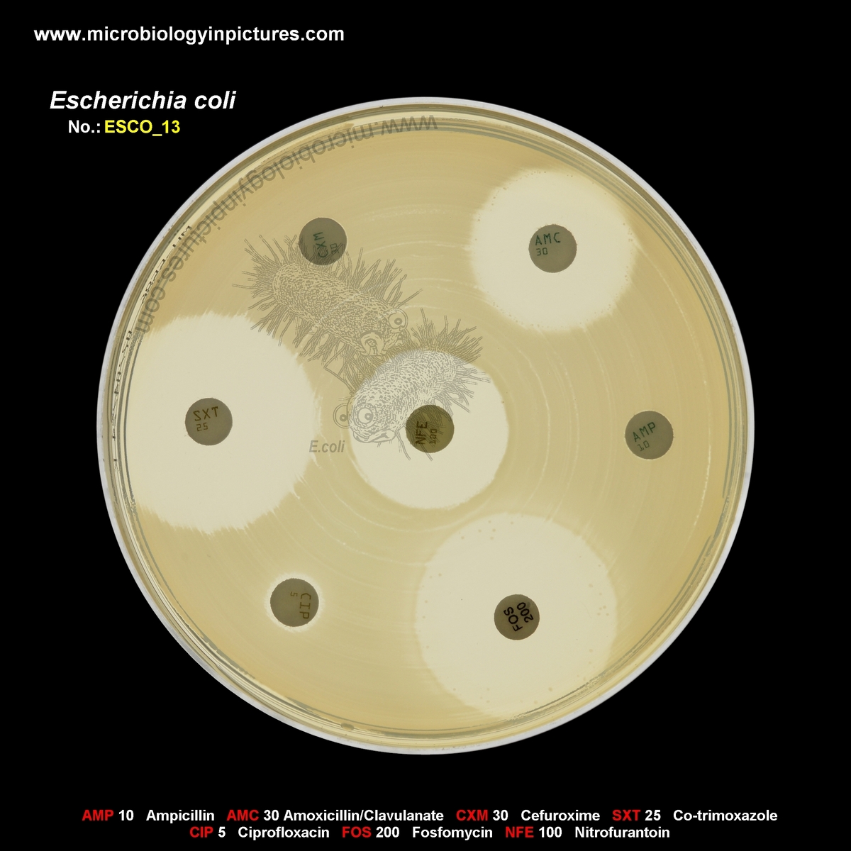 E.coli ESBL +