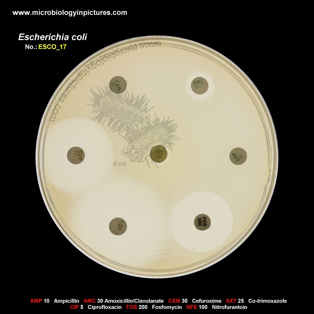 E.coli AMP, AMC, CRX, NFE, FOS resistant, ESBL positive