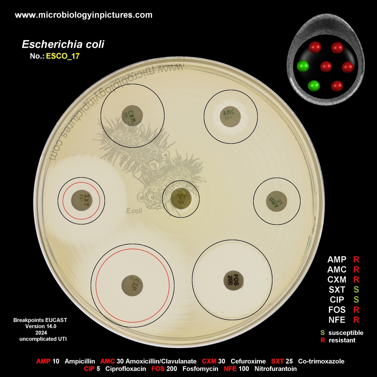 E.coli AMP, AMC, CRX, NFE, FOS resistant, ESBL positive
