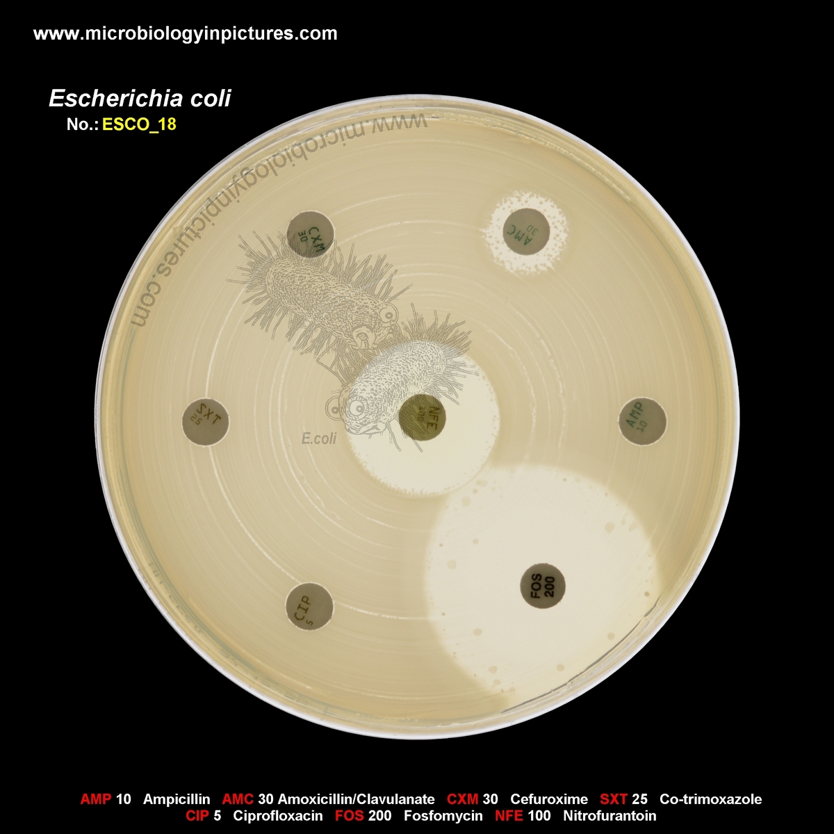 E.coli multiresistant