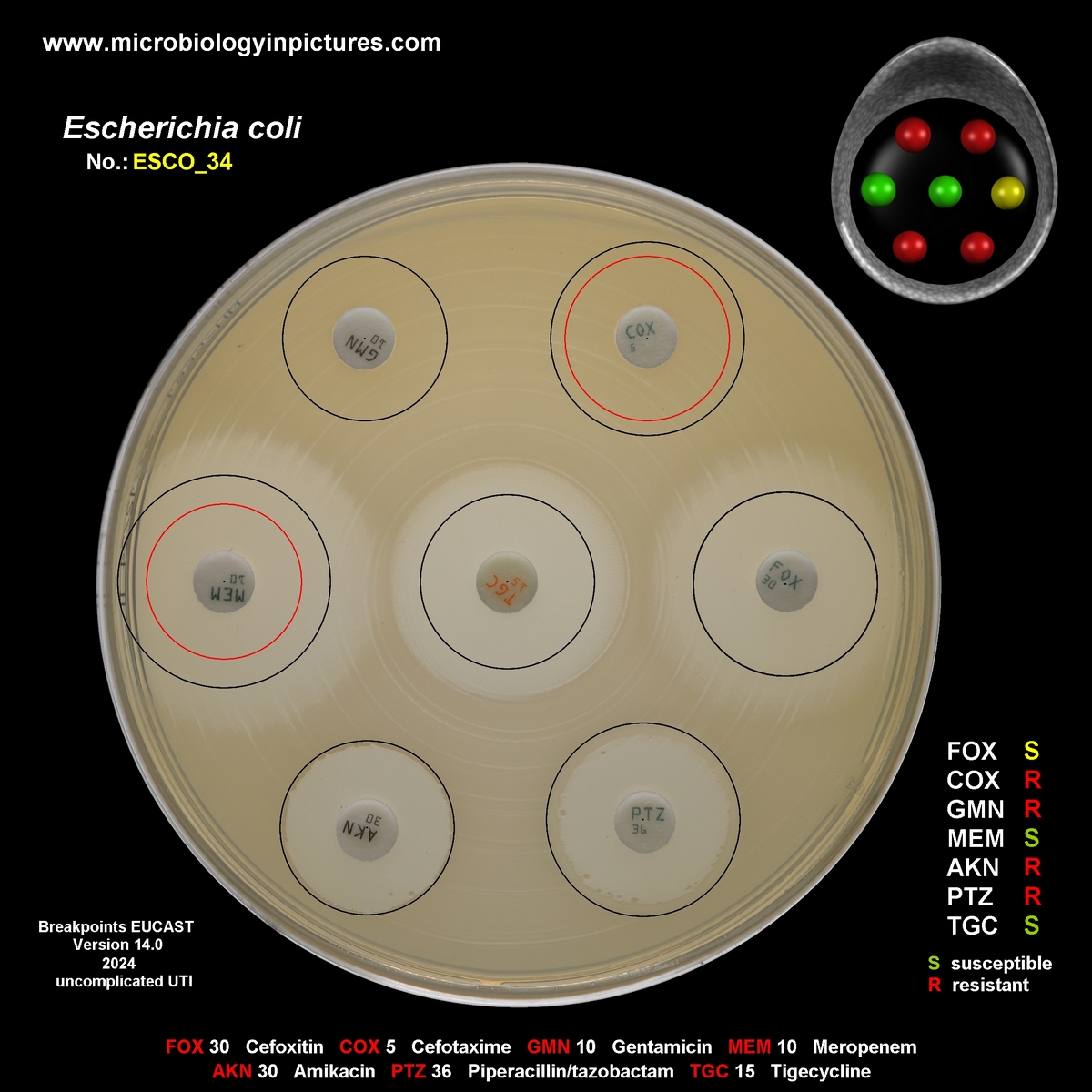 E.coli producing ESBL