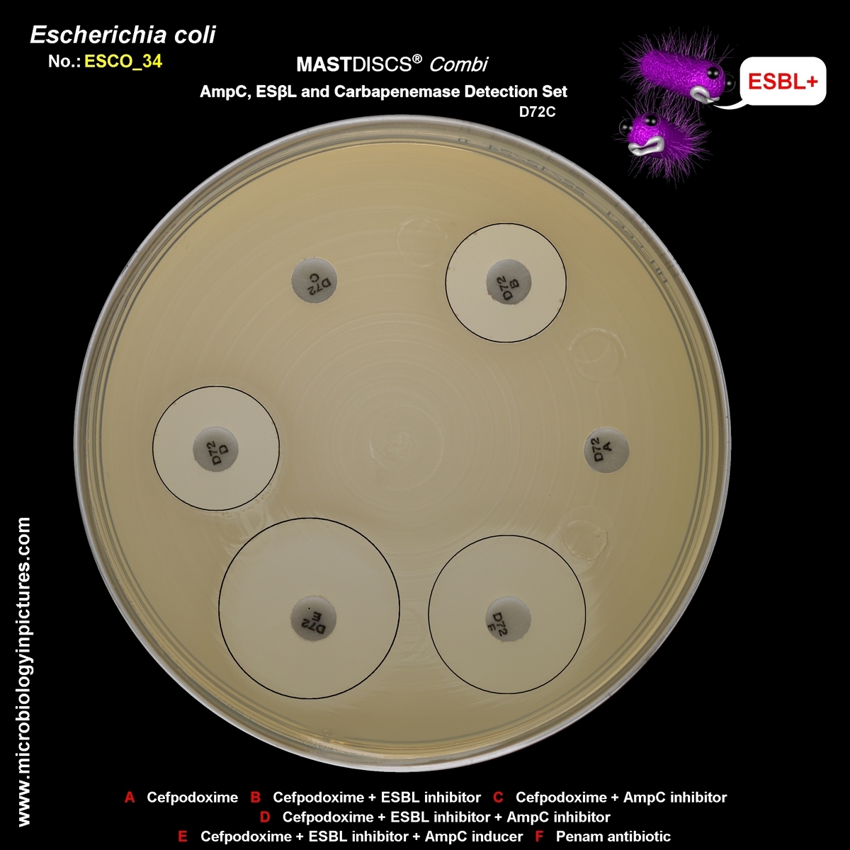 mastdiscs combi, ESBL constitutive