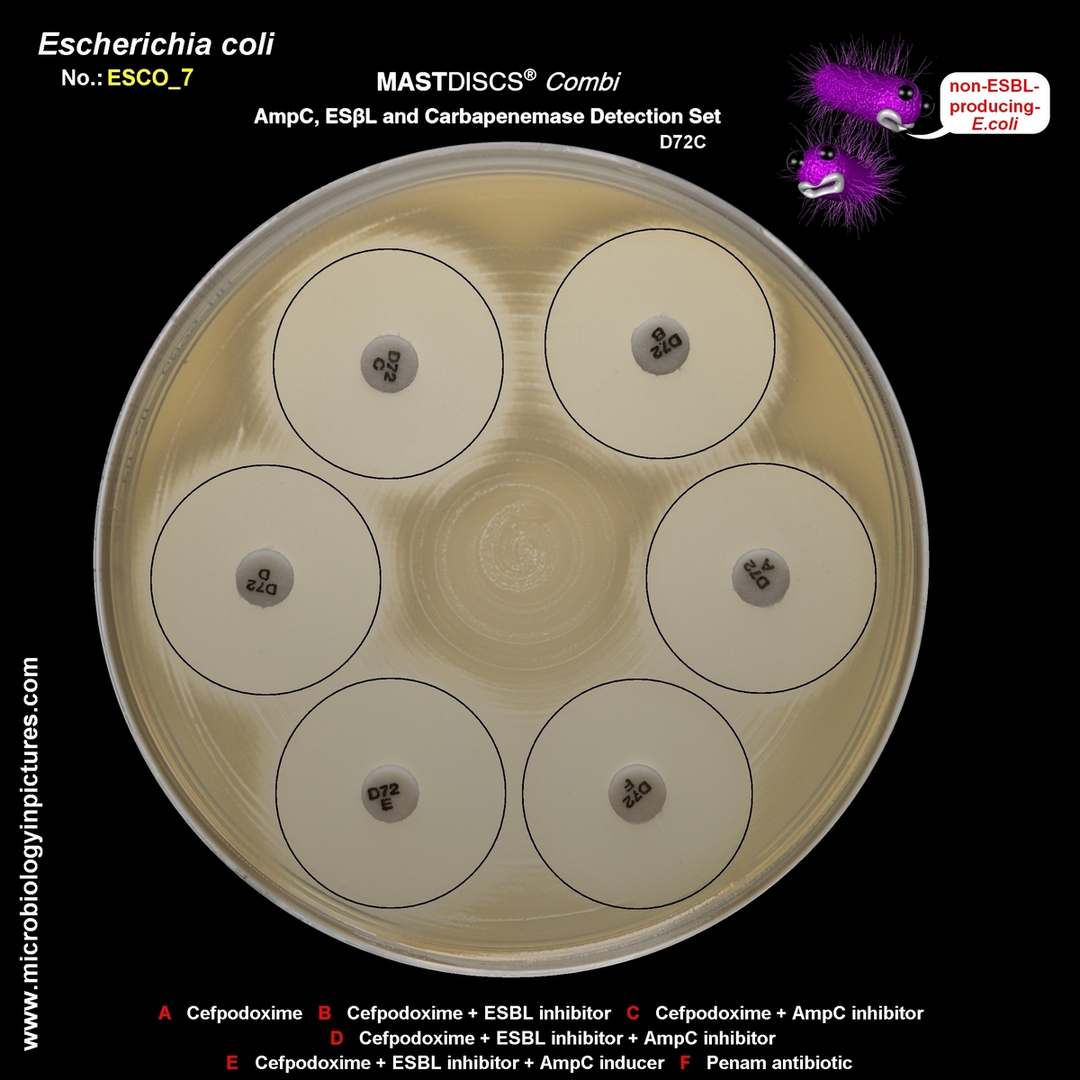 mastdiscs combi