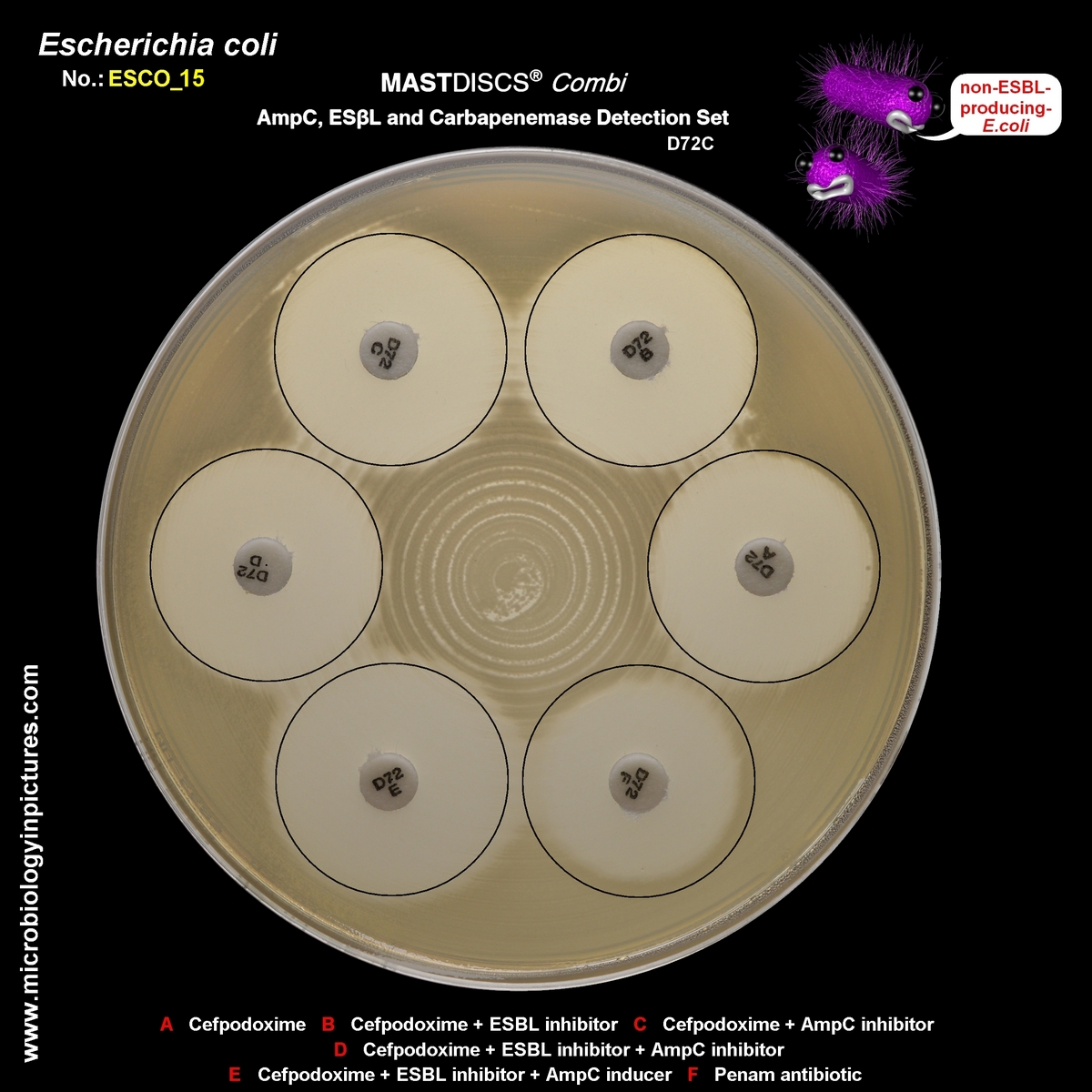 mastdiscs combi
