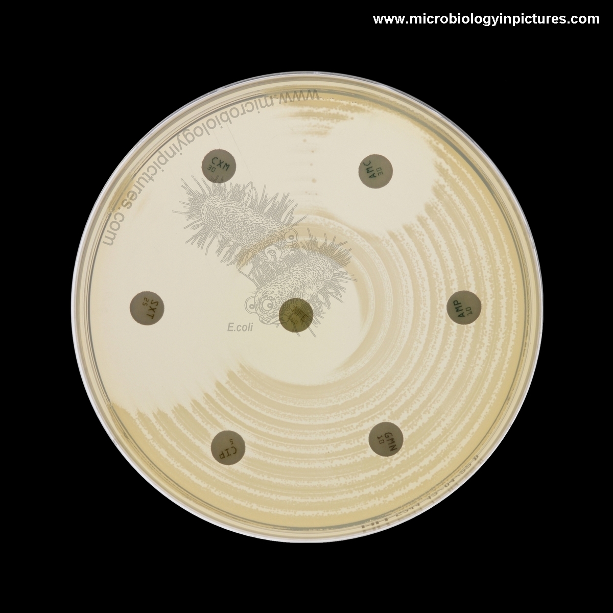 Inodulated plate with the antibiotic disks