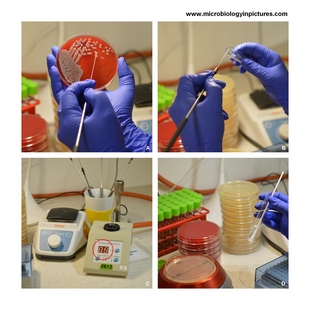 disk diffusion test