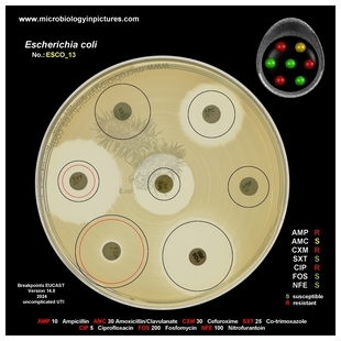 E.coli ESBL+, augmentin susceptible