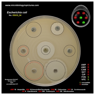 E.coli ESBL