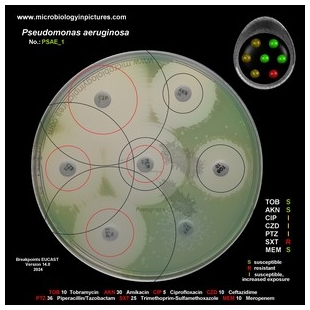 p.aeruginosa antibiotic testing