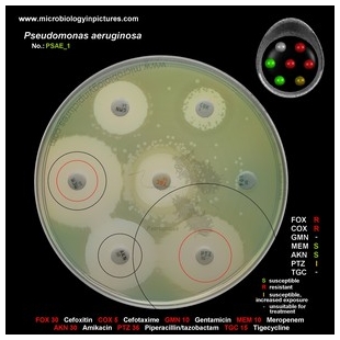 p.aeruginosa antibiotic testing