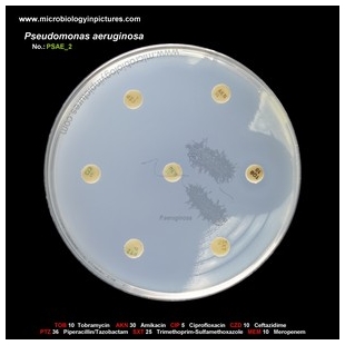 p.aeruginosa antibiotic testing
