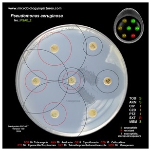 p.aeruginosa antibiotic testing