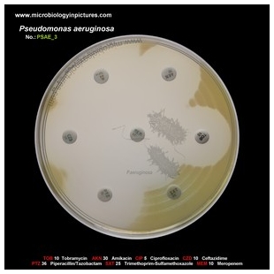 p.aeruginosa antibiotic testing