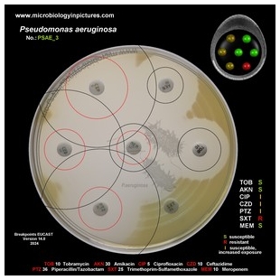 p.aeruginosa antibiotic testing