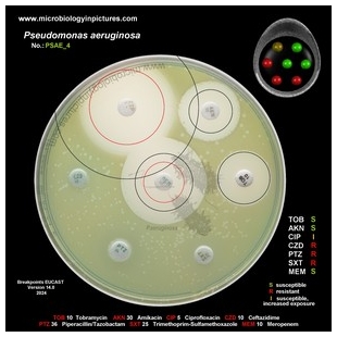 p.aeruginosa antibiotic testing