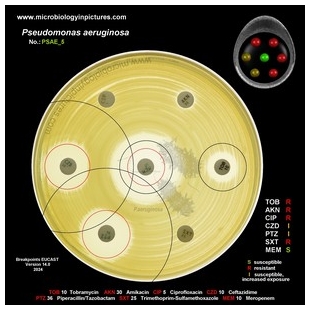 p.aeruginosa antibiotic testing