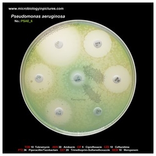 p.aeruginosa antibiotic testing