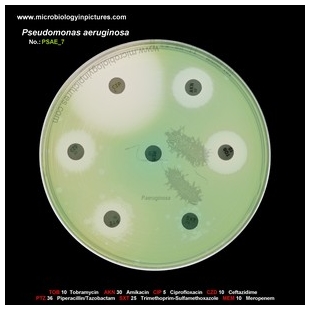 p.aeruginosa antibiotic testing