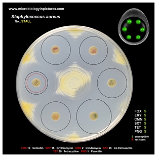 s.aureus antibiogram 1 breakpoints