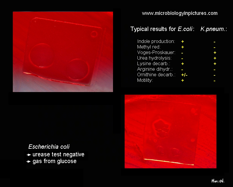 Escherichia coli urea hydrolysis
