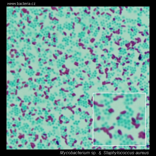 Ziehl-Neelsen stain, Z-N staining technique
