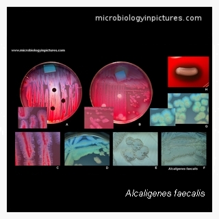alcaligenes