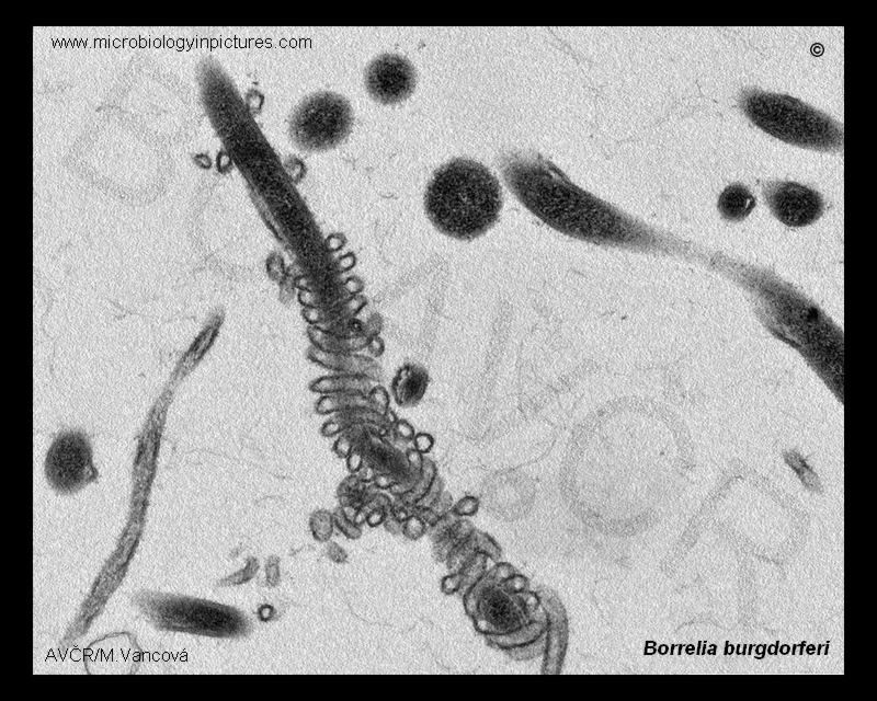 b.burgdorferi flagella TEM