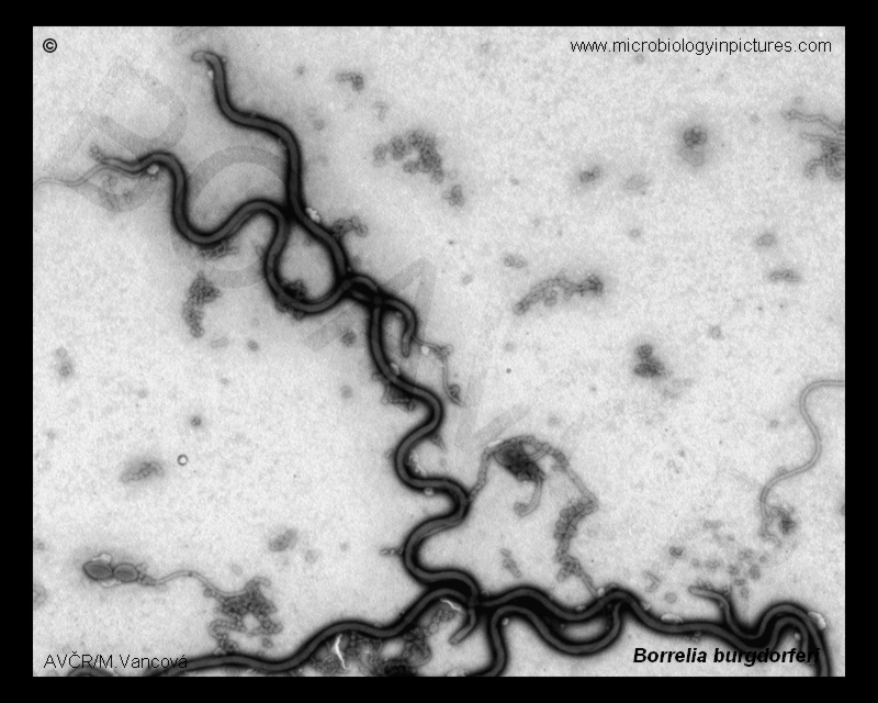 b.burgdorferi tem
