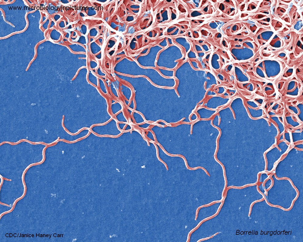 cause of borreliosis