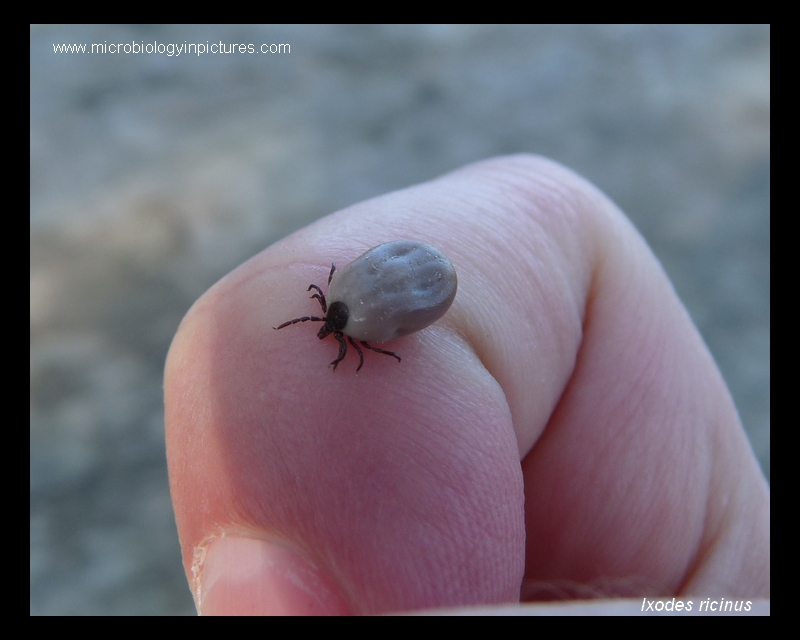 I.ricinus tick