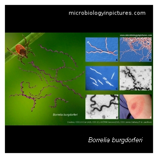 borrelia