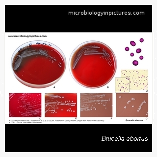 brucella