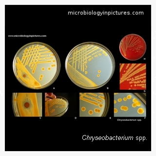 chryseobacterium