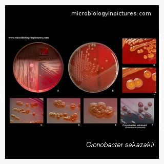cronobacter