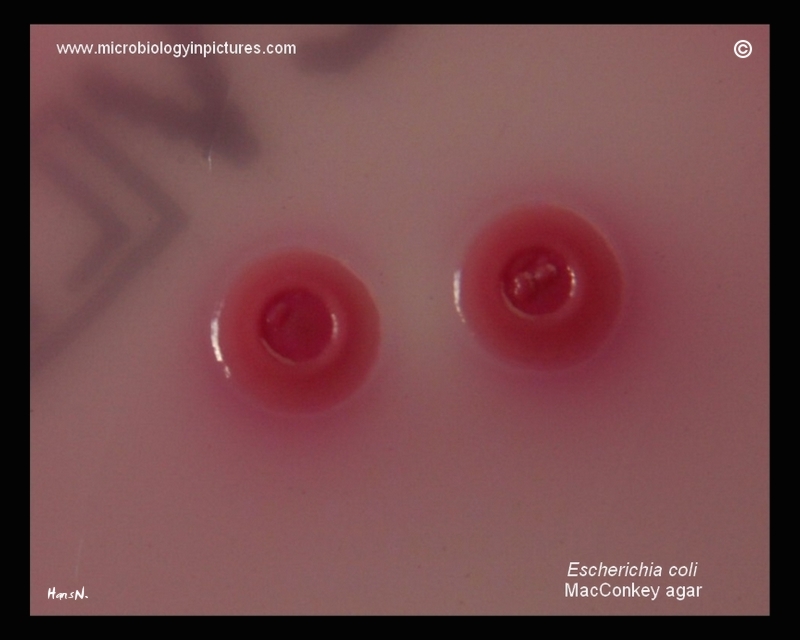 E.coli, concave colony