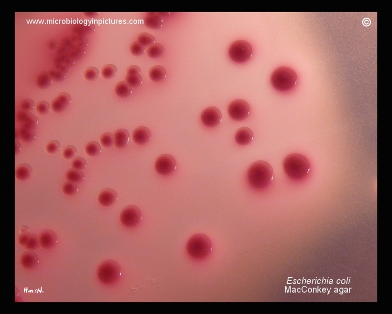 E.coli, Proteus sp.