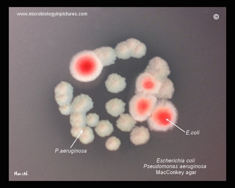 E.coli, Pseudomonas colonies