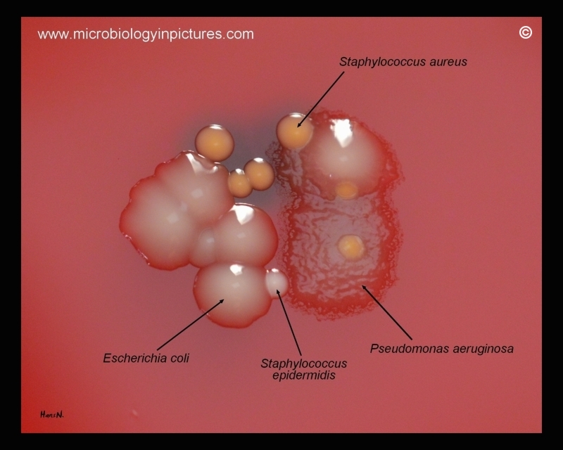 E.coli, S.aureus, S.epidermidis, P.aeruginosa