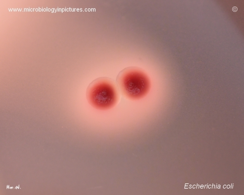 E.coli on agar