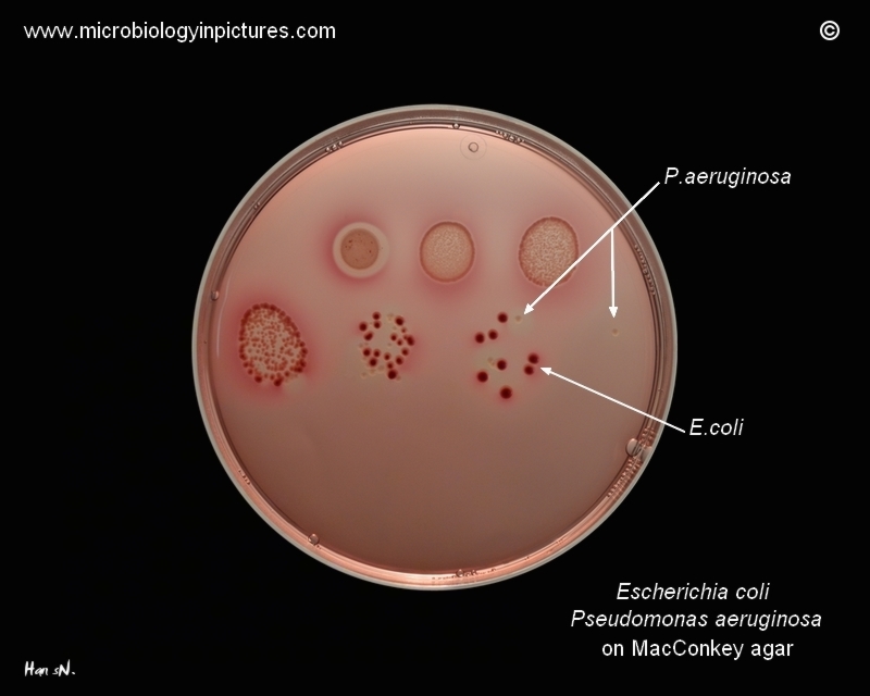 E.coli P.aeruginosa