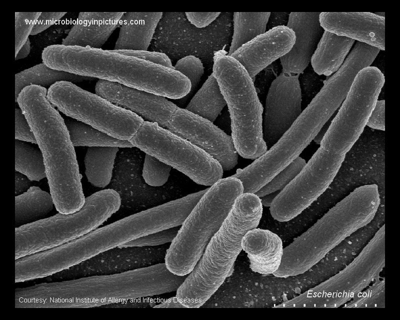 E.coli electon micrograph