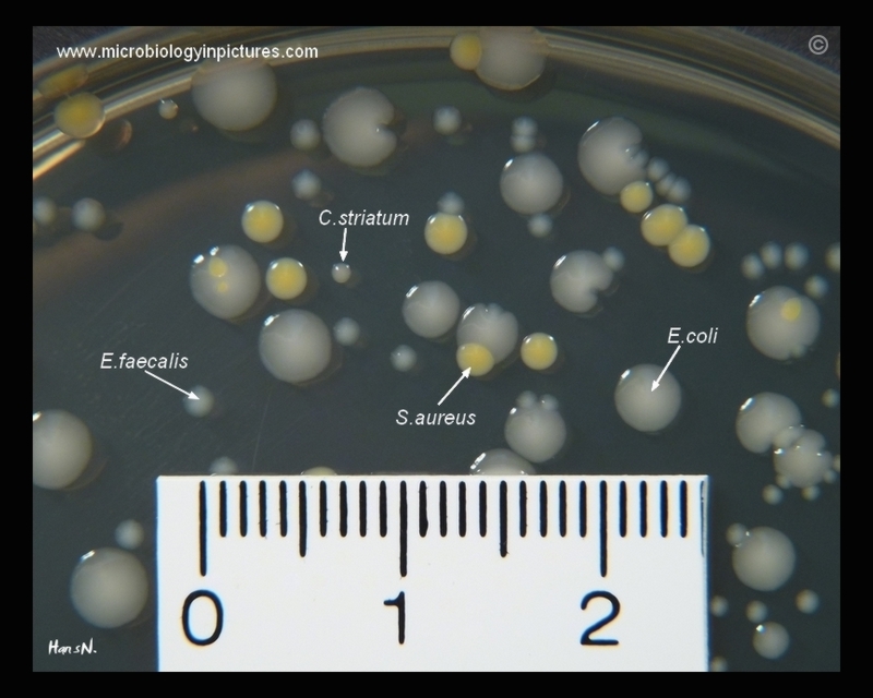 bacteria on TSA