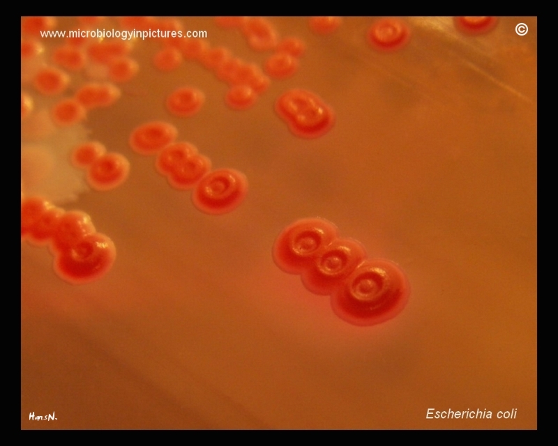 E.coli, concave colony