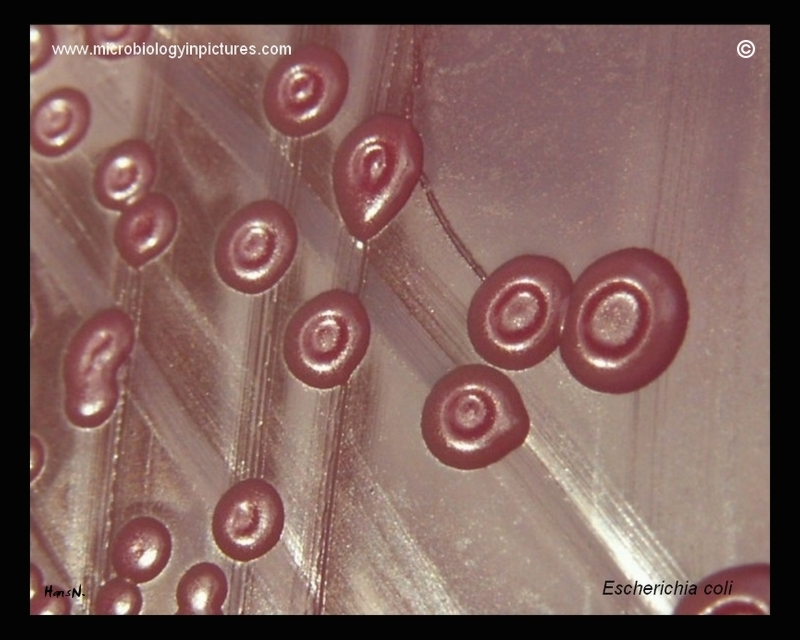 E.coli, concave colonies